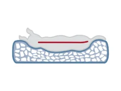 Trixie Vital Bett Bendson Orthopädisches Hundebett -Günstiges Hundeshop Geschäft 857623 Product